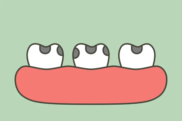 Çürük Diş Diş Çürüğü Diş Çizgi Film Düz Stil Şirin — Stok Vektör