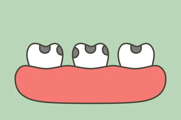 Кариес Кариеса Кариеса Зубов Карикатура Вектор Плоский Стиль Милый Характер — стоковый вектор