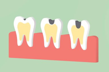 adım çürüğü diş - diş çizgi film 3d render düz stil şirin karakter tasarımı için