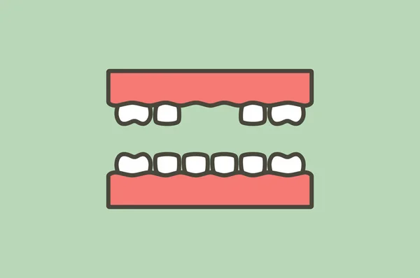 Diente Faltante Espacio Entre Los Dientes Vector Dibujos Animados Dental — Archivo Imágenes Vectoriales