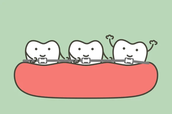 Ortodontia Dentes Aparelho Dentário Desenho Animado Dente Estilo Plano Vetor — Vetor de Stock