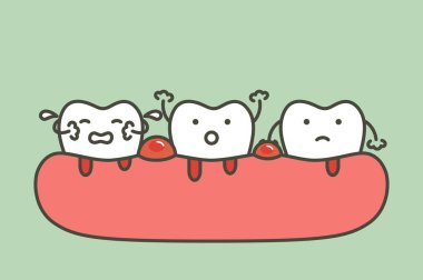 kanama periodontitis veya dişeti hastalığı (kan akımı geliyor dişeti ve diş), diş diş sorunu - karikatür vektör düz stil şirin karakter tasarımı için
