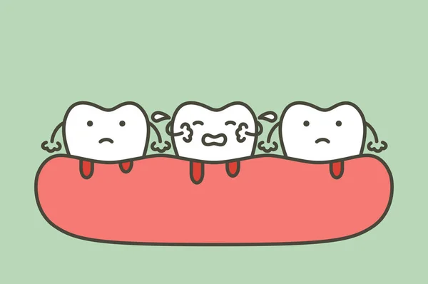 牙周炎或牙龈疾病出血 血流来自牙龈和牙齿 牙科问题 牙齿卡通矢量扁平式设计的可爱字符 — 图库矢量图片