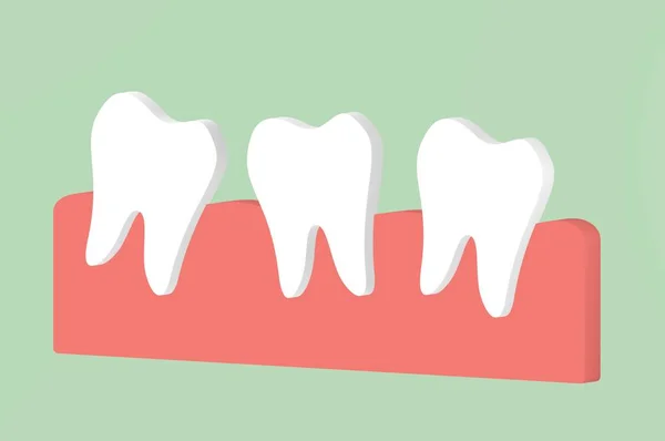 Křivé Zuby Zubní Kreslený Vykreslení Ploché Styl Roztomilý Znak Pro — Stock fotografie