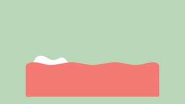 ortodontik diş veya diş diş teli - diş çizgi film vektör düz stil işlemek 2d görüntüleri animasyon, 4k ve Uhd ultra yüksek çözünürlüklü video formatı 3840 x 2160