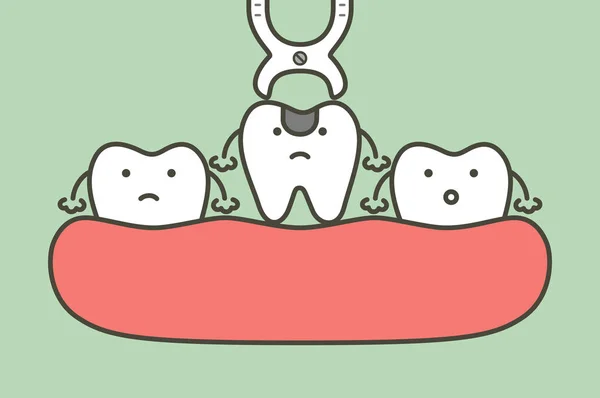 Extracción dental mediante herramientas dentales para eliminar la caries dental — Archivo Imágenes Vectoriales