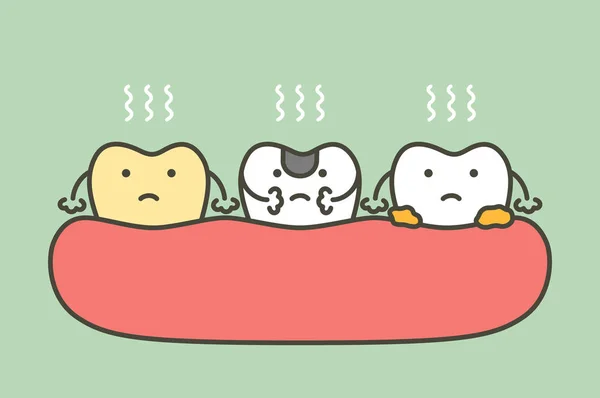 Set van tand is halitose of slechte adem — Stockvector