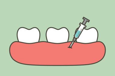 diş çekimi, şırınga ve anesthetizing için diş enjeksiyon