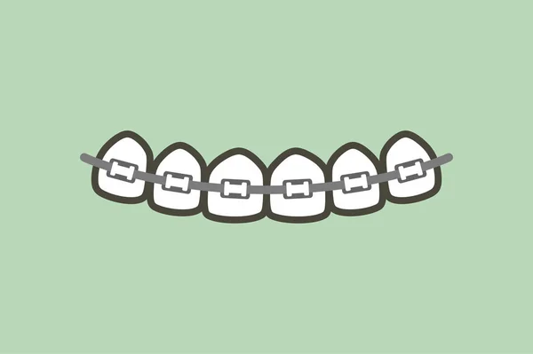 Orthodontie dents ou appareils dentaires — Image vectorielle