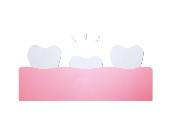First tooth, tooth growing up from gum and other teeth — Stock Photo, Image