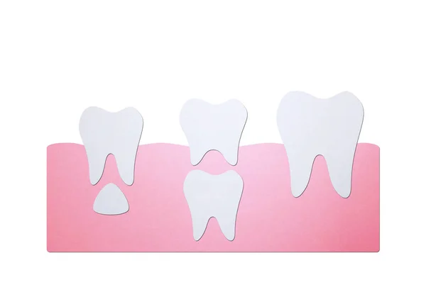 Permanent tooth located below primary tooth — Stock Photo, Image