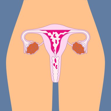 Hayız olduğunu bir kadının aylık kanama. Menstrüel akışı. Kadının vücut sağlık vektör çizim. Adet döngüsü