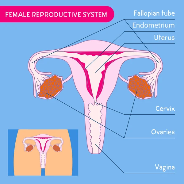 女性の生殖システムです 人間の解剖学 女性の生殖システム方式で子宮の医療ポスター ベクトル図 — ストックベクタ