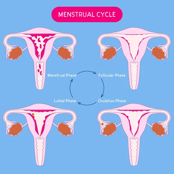 Menstruasjonssyklus Kvinnekritiske Dager Uterus Menstruasjonsvektorillustrasjon Kvinnelig Forplantningssystem Helsehjelp Illustrasjon Medisinsk – stockvektor