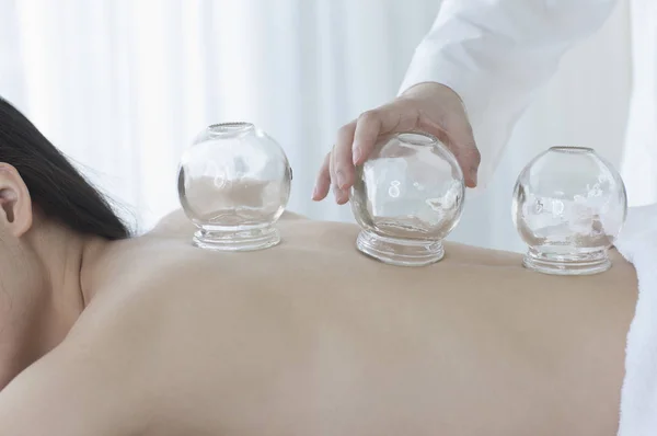 Jonge Aziatische Vrouw Met Een Cupping Therapie — Stockfoto