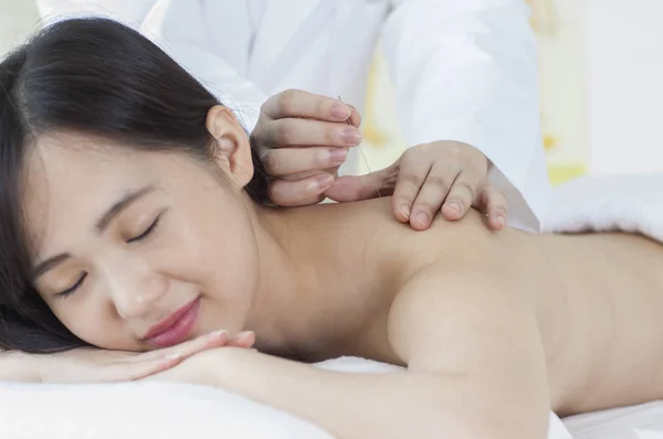 Young Asian Woman Getting Acupuncture Her Back — 图库照片