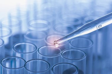 Laboratuvar cam. Tıbbi cam şişeler. Laboratuvar tanılama