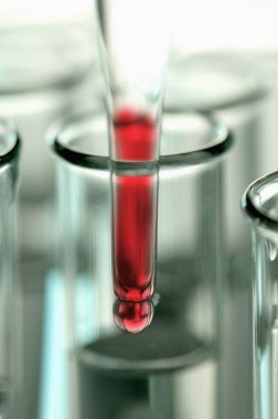 Laboratuvarda kan örneğiyle test tüpü