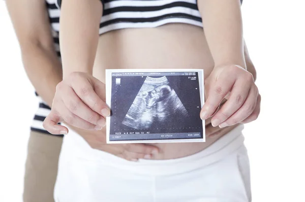 Asian Preggo