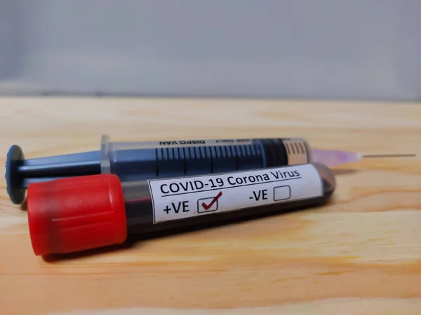 Positive Blood Sample Tube Collected Corona Virus Covid — Stock Photo, Image