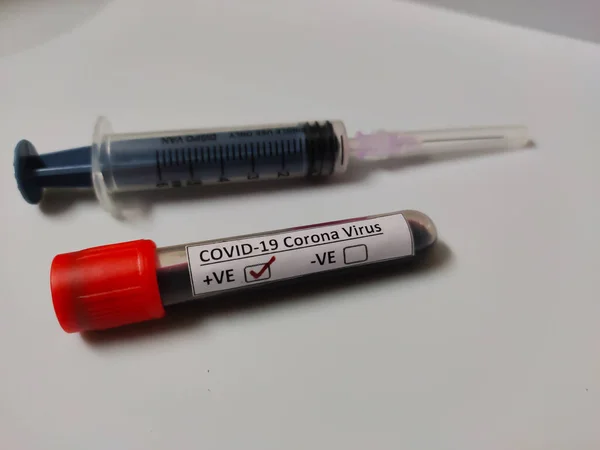 Muestra Sangre Positiva Tubo Recogido Para Virus Corona Covid —  Fotos de Stock