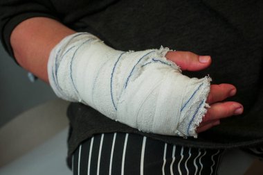 Kadın el el cerrahi bekleme odasında oturuyor, sonra kol bandaj ile closeup