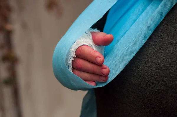 Kadın el el cerrahisi, sonra kol bandaj ile closeup