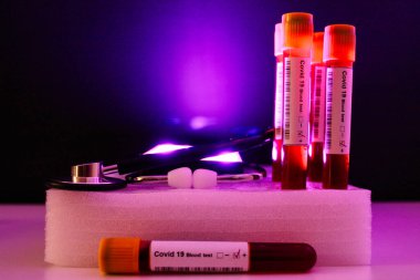 covid 19 pozitif kan testi