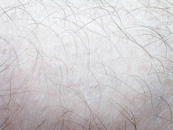Close up of my hairy leg. Mobile phone photo with some mobile phone/tablet style processing.