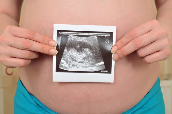 彼女の赤ちゃんのバンプの上に超音波画像を保持している期待される母親のクローズアップ ロイヤリティフリーのストック写真