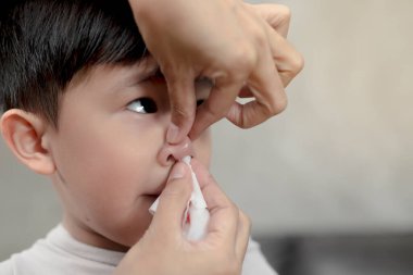 Burnu kanayan Asyalı şirin çocuğun portresi burun kanamaları için ilk yardım konsepti..