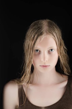 Albino kadın ıslak sarışın uzun saçlı, albinizm. Albino kız mavi gözlü ve beyaz deri ile.