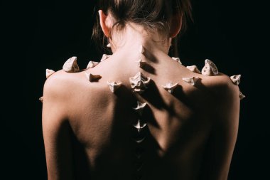 Dikenli siyah arka plan üzerine izole kadın geri döndü. Omurga, boyunca çıplak deri üzerinde dikenler kızla geri dön. Kemik problemleri, ağrı, tıbbi tedavi ve sağlık kavramı.