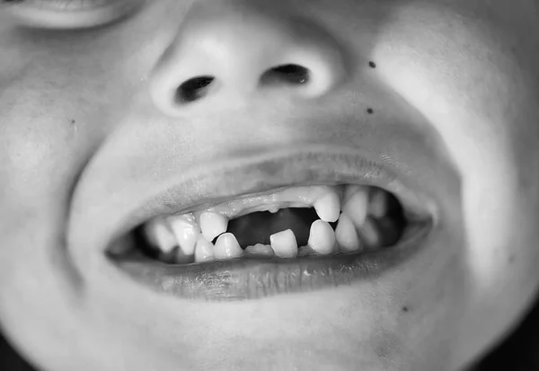 Dokter gigi. Anak dengan gigi yang hilang — Stok Foto