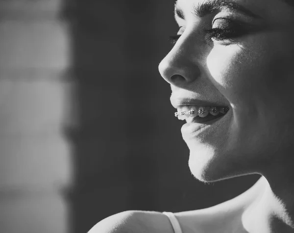 Tirantes. atención dental. Mujer con tirantes en los dientes sonrisa — Foto de Stock