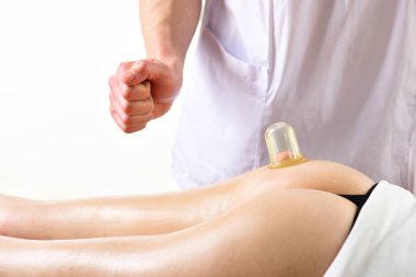 Selülit. Selülit çukurluğu kavanoz terapi spa salonu. mükemmel kalçalar için mücadele selülit. adam yapar masaj için kadın - kavanoz çukurluğu selülit. mükemmel görünümlü