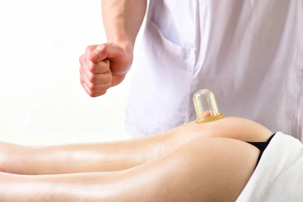 cellulite. cellulite cupping jar therapy in spa salon. cellulite fighting for perfect buttocks. man makes cupping jar massage for woman - cellulite. looking just perfect
