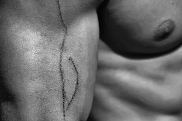 Scratches on the body. Abrasion on muscular male hand — Stock Photo, Image