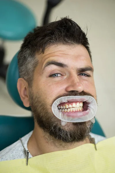 Comparaison après blanchiment des dents. Enseigner aux patients les régimes alimentaires, la soie dentaire, l'utilisation du fluorure et d'autres aspects des soins dentaires . — Photo