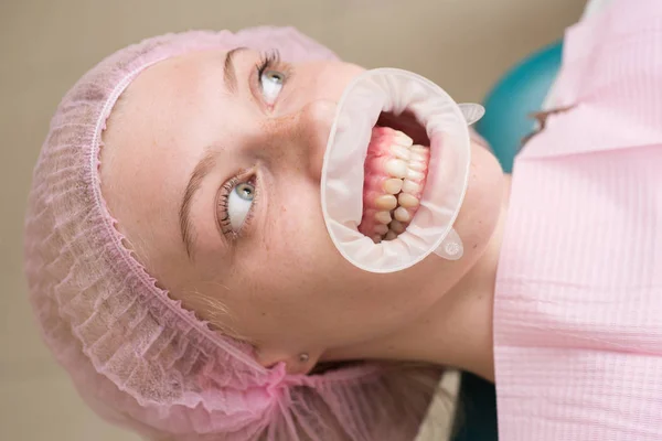 Comparison after teeth whitening. Make models and measurements for dental appliances, such as dentures, to fit patients. Teach patients about diets, flossing and other aspects of dental care. — Stock Photo, Image