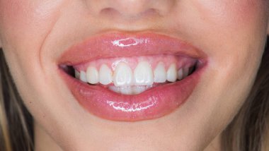 Bir gülümseme içine zorla. Seksi dudaklar. Seksi kadın beyaz bir gülümseme ile. Dudaklar için silikon enjeksiyonu. Silikon diş diş telleri. Diş Bakımı. Yüz botox. Botox ve dolgu. Bezemeler yüzüm için makyaj olduğunu