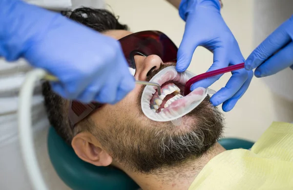 Brodaty mężczyzna zęby zbadane na dentystów. Zbliżenie na mężczyzn pacjenta z brodą z otworzyć usta, siedzi w krzesło lekarskie i lekarz z asystentem Dokonywanie zęby sprawdzić się w klinice stomatologicznej. — Zdjęcie stockowe