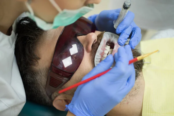 Blanchiment des dents à la lumière ultraviolette - lampe UV. Homme au cabinet de dentistes ayant un traitement dentaire. Homme choisissant la couleur des dents chez le dentiste . — Photo