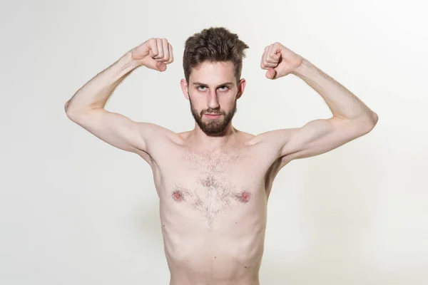 Skinny young man flex arms. Slim man do sport training. Stimulating muscle growth with anabolic steroids. Man increases muscle strength with anabolic hormone. Sport and fitness — Stock Photo, Image