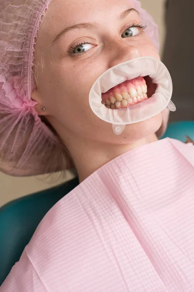 Young blond female opening her mouth while unidentifiable dentist in latex gloves check condition of her teeth. Happy woman smiling on an abstract background with blurred lights. — Stock Photo, Image