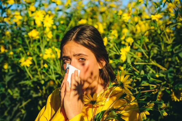 Девушка страдает аллергией на пыльцу во время цветения и пользуется салфетками. Красивая сексуальная молодая женщина лежит на фоне цветов. Аллергия . — стоковое фото