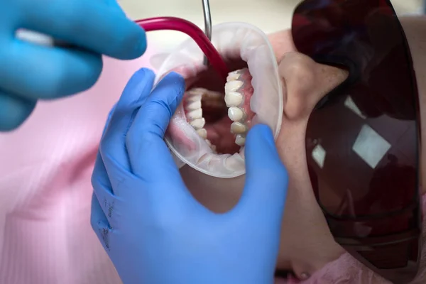 Les gens, la médecine, la stomatologie et le concept de soins de santé - gros plan d'une dentiste avec miroir dentaire qui vérifie les dents des patients masculins au cabinet de la clinique dentaire. Gros plan de la bouche féminine . — Photo