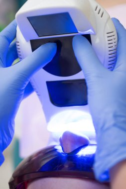 Diş hekimi diş office hoş bir ortamda bir kadın hastada kür. Güzel kızı muayene diş hekimi, diş sandalye.