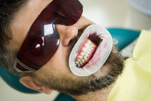 Retrato de hombre alegre con dientes blancos como la nieve. Hombre mayor recibiendo tratamiento dental en el consultorio de dentistas. Hermosa sonrisa del hombre europeo con dientes sanos blanqueamiento . — Foto de Stock