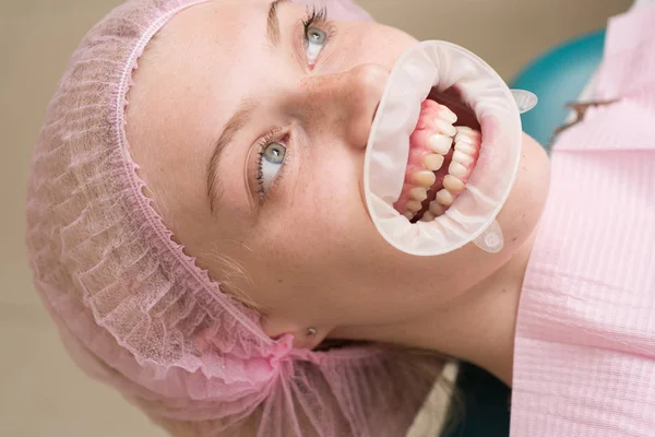 Happy woman smiling on an abstract background with blurred lights. Healthy white smile. Brush your Teeth. Matching the shades of the implants or the process of teeth whitening. — Stock Photo, Image